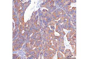 IHC analysis of PTGES2/Gbf1 using anti-PTGES2/Gbf1 antibody (ABIN7599616).