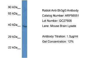 Western Blotting (WB) image for anti-Endophilin-A3 (SH3GL3) (Middle Region) antibody (ABIN2786768) (SH3GL3 anticorps  (Middle Region))