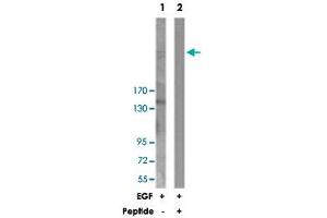 Western blot analysis of extracts from 293 cells, treated with EGF (200 ng/mL, 30 mins), using ESPL1 polyclonal antibody . (Separase anticorps)