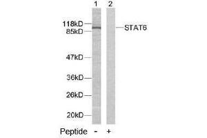 Image no. 2 for anti-Signal Transducer and Activator of Transcription 6, Interleukin-4 Induced (STAT6) (Tyr641) antibody (ABIN197184) (STAT6 anticorps  (Tyr641))