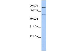 WB Suggested Anti-ESR1 Antibody Titration:  0. (Estrogen Receptor alpha anticorps  (Middle Region))