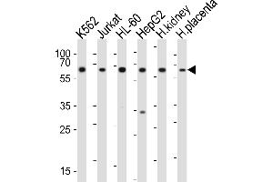 Western blot analysis of lysates from K562, Jurkat, HL-60, HepG2 cell line, human kidney, human placenta tissue(from left to right), using EPOR Antibody (C-term) (ABIN6243002 and ABIN6577698). (EPOR anticorps  (C-Term))