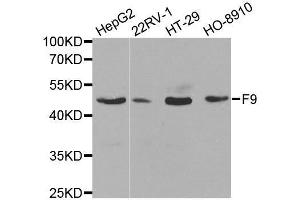 Western blot analysis of extracts of various cell lines, using F9 antibody. (Coagulation Factor IX anticorps  (AA 29-192))