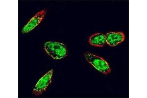 Confocal immunofluorescent analysis of c-Src antibody with A375 cells followed by Alexa Fluor 488-conjugated goat anti-rabbit lgG (green).