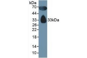 Detection of APOD in Human Serum using Polyclonal Antibody to Apolipoprotein D (APOD) (Apolipoprotein D anticorps  (AA 21-189))
