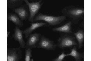 Immunofluorescent staining of HeLa (ATCC CCL-2) cells. (Crk anticorps  (AA 102-304))