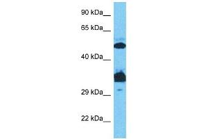 Host:  Rabbit  Target Name:  SP7  Sample Type:  Jurkat Whole Cell lysates  Antibody Dilution:  0. (SP7 anticorps  (C-Term))
