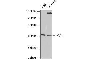Western blot analysis of extracts of various cell lines, using MVK antibody (ABIN6128256, ABIN6144204, ABIN6144205 and ABIN6220991) at 1:1000 dilution. (MVK anticorps  (AA 40-300))