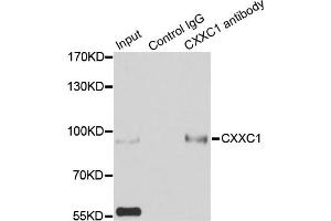 Immunoprecipitation analysis of 200ug extracts of HepG2 cells using 3ug CXXC1 antibody. (CXXC1 anticorps)