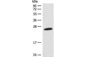 Western blot analysis of Mouse skin tissue lysate using CSNK2B Polyclonal Antibody at dilution of 1:400