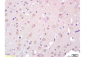 Formalin-fixed and paraffin embedded rat brain labeled with Rabbit Anti ROR1/ROR alpha Polyclonal Antibody, Unconjugated (ABIN1387717) at 1:200 followed by conjugation to the secondary antibody and DAB staining (ROR1 anticorps  (AA 301-360))