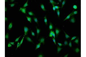 Immunofluorescence staining of NIH/3T3 cells with ABIN7157862 at 1:66, counter-stained with DAPI.