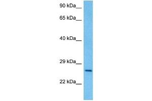 Host:  Rat  Target Name:  PAX4  Sample Tissue:  Rat Brain  Antibody Dilution:  1ug/ml
