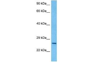 Host:  Rat  Target Name:  PAX4  Sample Tissue:  Rat Brain  Antibody Dilution:  1ug/ml (PAX4 anticorps  (Middle Region))