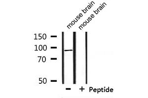 Western blot analysis of extracts from mouse brain, using HCN2 Antibody.