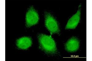 Immunofluorescence of monoclonal antibody to CBLL1 on HeLa cell. (CBLL1 anticorps  (AA 1-100))
