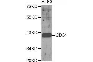 Western blot analysis of extracts of HL60 cell, using CD34 antibody. (CD34 anticorps  (AA 32-290))