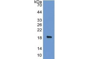 WB of Protein Standard: different control antibodies against Highly purified E.