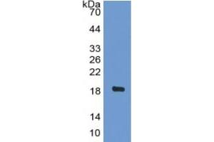 WB of Protein Standard: different control antibodies against Highly purified E. (BNP Kit ELISA)