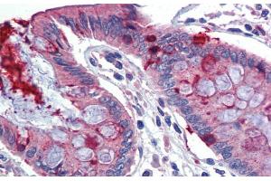 Immunohistochemistry with Human Colon lysate tissue at an antibody concentration of 5. (LIN7C anticorps  (N-Term))