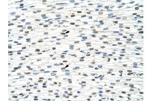 DDX19B antibody was used for immunohistochemistry at a concentration of 4-8 ug/ml to stain Myocardial cells (arrows) in Human Heart. (DDX19B anticorps)