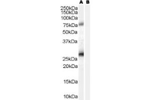 Image no. 1 for anti-Estrogen Receptor Binding Site Associated, Antigen, 9 (EBAG9) (C-Term) antibody (ABIN374701) (RCAS1 anticorps  (C-Term))