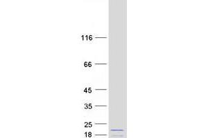 Validation with Western Blot