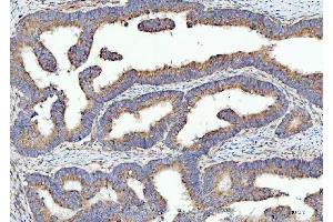 IHC analysis of SPATA18 using anti-SPATA18 antibody (ABIN7601020). (SPATA18 anticorps  (AA 27-490))