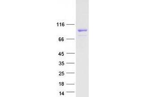 Validation with Western Blot (LZTS2 Protein (Myc-DYKDDDDK Tag))