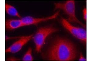Image no. 1 for anti-Protein Kinase D1 (PRKD1) (pSer738) antibody (ABIN196754) (PKC mu anticorps  (pSer738))