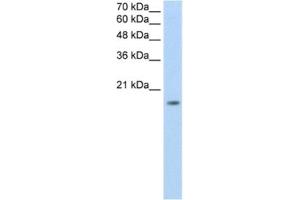 Western Blotting (WB) image for anti-Zinc Finger Protein 580 (ZNF580) antibody (ABIN2461874) (ZNF580 anticorps)