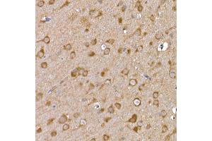 Immunohistochemistry of paraffin-embedded rat brain using GFR Rabbit pAb (ABIN6127950, ABIN6141065, ABIN6141066 and ABIN6221017) at dilution of 1:100 (40x lens).