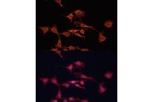 Immunofluorescence analysis of C6 cells using GSTM3 antibody (ABIN6131967, ABIN6141470, ABIN6141471 and ABIN6223605) at dilution of 1:100. (GSTM3 anticorps  (AA 101-225))