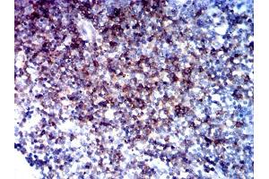Immunohistochemical analysis of paraffin-embedded tonsil tissues using CD5 mouse mAb with DAB staining. (CD5 anticorps  (AA 403-495))