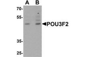 Western blot analysis of POU3F2 in 3T3 cell lysate with POU3F2 antibody at (A) 1 and (B) 2 μg/mL. (POU3F2 anticorps  (C-Term))