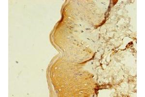 Immunohistochemistry of paraffin-embedded human skin tissue using ABIN7159241 at dilution of 1:100