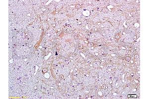 Formalin-fixed and paraffin embedded rat brain tissue labeled with Anti-IL-18 Polyclonal Antibody (ABIN669696), Unconjugated at 1:200, followed by conjugation to the secondary antibody and DAB staining (IL-18 anticorps)
