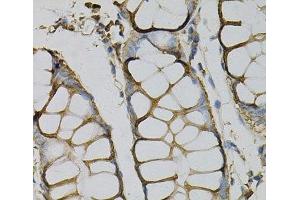 Immunohistochemistry of paraffin-embedded Human colon using AZGP1 Polyclonal Antibody at dilution of 1:100 (40x lens). (AZGP1 anticorps)