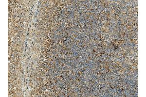 Immunohistochemistry analysis using Rabbit Anti-Rubicon Polyclonal Antibody (ABIN5066357).