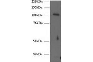 Image no. 1 for anti-Unc-13 Homolog D (UNC13D) (C-Term) antibody (ABIN374437) (UNC13D anticorps  (C-Term))