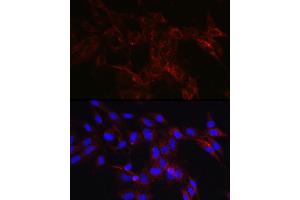 Immunofluorescence analysis of C6 cells using [KO Validated] HK1 Rabbit pAb (ABIN3021308, ABIN3021309, ABIN3021310 and ABIN6214823) at dilution of 1:50 (40x lens).