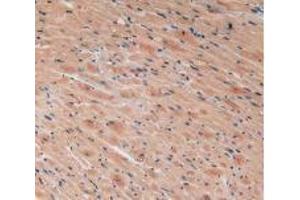 IHC-P analysis of Mouse Heart Tissue, with DAB staining. (VEGFC anticorps  (AA 108-223))