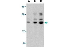 Western blot analysis of CASP6 in Jurkat cell lysate with CASP6 polyclonal antibody  at (A) 0. (Caspase 6 anticorps  (N-Term))