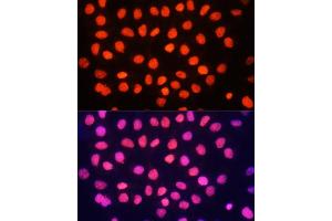 Immunofluorescence analysis of HeLa cells using TriMethyl-Histone H3-K64 antibody (ABIN7267701) at dilution of 1:100.