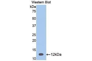 Western Blotting (WB) image for anti-serpin Peptidase Inhibitor, Clade A (Alpha-1 Antiproteinase, Antitrypsin), Member 12 (SERPINA12) (AA 52-143) antibody (ABIN3208031) (SERPINA12 anticorps  (AA 52-143))