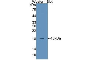 Detection of Recombinant SNAPAP, Human using Polyclonal Antibody to SNAP Associated Protein (SNAPAP) (SNAPIN anticorps  (AA 2-136))