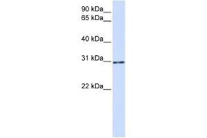 AKT1S1 antibody used at 1 ug/ml to detect target protein. (PRAS40 anticorps)
