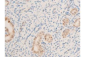 ABIN6267234 at 1/100 staining rat uterine tissue sections by IHC-P.