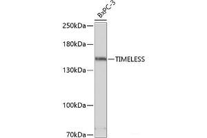 Western blot analysis of extracts of BxPC-3 cells using TIMELESS Polyclonal Antibody at dilution of 1:3000. (TIMELESS anticorps)