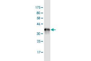 Western Blot detection against Immunogen (35. (ADNP anticorps  (AA 1018-1102))